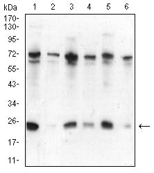 Figure 4:Western blot analysis using CBX5 mouse mAb against Hela (1), NIH/3T3 (2), K562 (3), MCF-7 (4), Jurkat (5), and A431 (6) cell lysate.