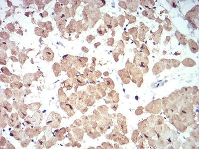 Figure 5:Immunohistochemical analysis of paraffin-embedded cardiac muscle tissues using ATG13 mouse mAb with DAB staining.