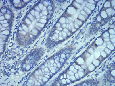 Figure 8:Immunohistochemical analysis of paraffin-embedded duodenum tissues using Rab5a mouse mAb with DAB staining.