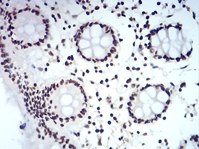 Figure 8:Immunohistochemical analysis of paraffin-embedded colon tissues using CBX5 mouse mAb with DAB staining.