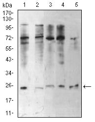 Figure 4:Western blot analysis using CBX5 mouse mAb against Hela (1), NIH/3T3 (2), K562 (3), MCF-7 (4), and A431 (5) cell lysate.