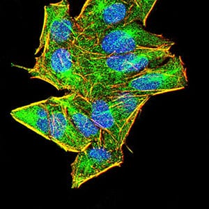 Figure 5:Immunofluorescence analysis of Hela cells using AIM2 mouse mAb (green). Blue: DRAQ5 fluorescent DNA dye. Red: Actin filaments have been labeled with Alexa Fluor- 555 phalloidin. Secondary antibody from Fisher (Cat#: 35503)