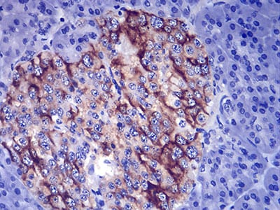 Figure 5:Immunohistochemical analysis of paraffin-embedded pancreas tissues using TSHB mouse mAb with DAB staining.