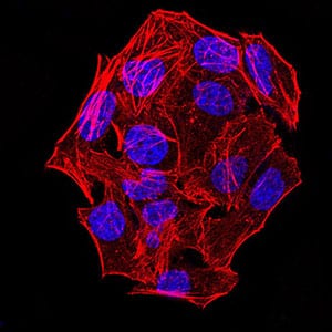Figure 3:Immunofluorescence analysis of Hela cells using phospho-NLRC4(Ser-533) rat mAb. Blue: DRAQ5 fluorescent DNA dye. Red: Actin filaments have been labeled with Alexa Fluor- 555 phalloidin.