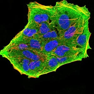 Figure 5:Immunofluorescence analysis of Hela cells using GFPT1 mouse mAb (green). Blue: DRAQ5 fluorescent DNA dye. Red: Actin filaments have been labeled with Alexa Fluor- 555 phalloidin. Secondary antibody from Fisher (Cat#: 35503)