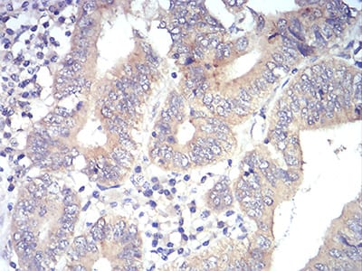 Figure 8:Immunohistochemical analysis of paraffin-embedded esophagus tissues using PLCG1 mouse mAb with DAB staining.
