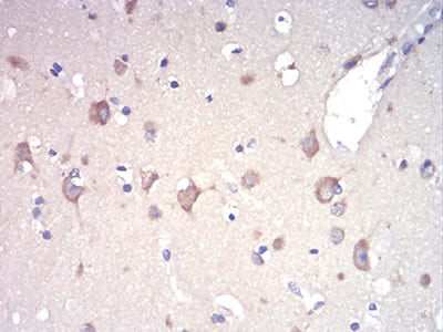 Figure 7:Immunohistochemical analysis of paraffin-embedded brain tissues using RAD21 mouse mAb with DAB staining.