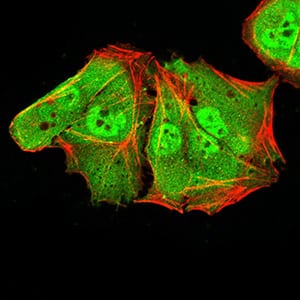 Figure 5:Immunofluorescence analysis of Hela cells using ALDH6A1 mouse mAb (green). Blue: DRAQ5 fluorescent DNA dye. Red: Actin filaments have been labeled with Alexa Fluor- 555 phalloidin. Secondary antibody from Fisher (Cat#: 35503)