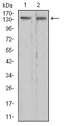 Figure 4:Western blot analysis using RAD50 mouse mAb against C6 (1) and HepG2 (2) cell lysate.