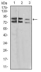 Figure 4:Western blot analysis using IL1RAPL1 mouse mAb against A431 (1), SK-Hep-1 (2), and HL-7702 (3) cell lysate.