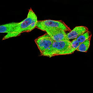 Figure 5:Immunofluorescence analysis of Hela cells using CFHR5 mouse mAb (green). Blue: DRAQ5 fluorescent DNA dye. Red: Actin filaments have been labeled with Alexa Fluor- 555 phalloidin. Secondary antibody from Fisher (Cat#: 35503)