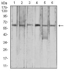 Figure 4:Western blot analysis using CFHR5 mouse mAb against HepG2 (1), K562 (2), L-02 (3), SK-Hep-1 (4), SMMC-7721 (5), and NIH/3T3 (6) cell lysate.