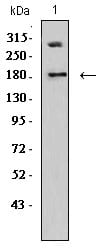 Figure 4:Western blot analysis using DNMT1 mouse mAb against Jurkat (1) cell lysate.