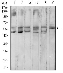 Figure 4:Western blot analysis using KRT10 mouse mAb against MCF-7 (1), Hela (2), HepG2 (3), T47D (4), HT-29 (5), and A549 (6) cell lysate.