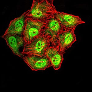 Figure 8:Immunofluorescence analysis of HepG2 cells using SYN1 mouse mAb (green). Blue: DRAQ5 fluorescent DNA dye. Red: Actin filaments have been labeled with Alexa Fluor- 555 phalloidin. Secondary antibody from Fisher (Cat#: 35503)