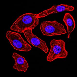 Figure 5:Immunofluorescence analysis of GC-7901 cells. Blue: DRAQ5 fluorescent DNA dye. Red: Actin filaments have been labeled with Alexa Fluor- 555 phalloidin. Secondary antibody from Fisher (Cat#: 35503)
