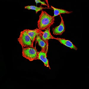 Figure 5:Immunofluorescence analysis of SK-OV-3 cells using ARF1 mouse mAb (green). Blue: DRAQ5 fluorescent DNA dye. Red: Actin filaments have been labeled with Alexa Fluor- 555 phalloidin. Secondary antibody from Fisher (Cat#: 35503)