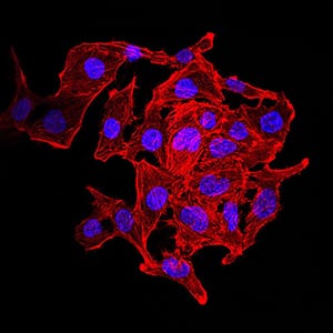 Figure 5:Immunofluorescence analysis of SK-OV-3 cells using KDM1A mouse mAb. Blue: DRAQ5 fluorescent DNA dye. Red: Actin filaments have been labeled with Alexa Fluor- 555 phalloidin.