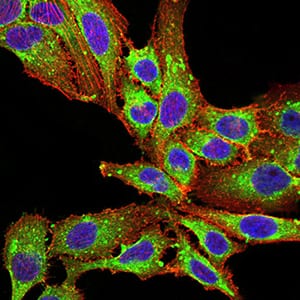 Figure 5:Immunofluorescence analysis of SK-OV-3 cells using PLD2 mouse mAb (green). Blue: DRAQ5 fluorescent DNA dye. Red: Actin filaments have been labeled with Alexa Fluor- 555 phalloidin. Secondary antibody from Fisher (Cat#: 35503)