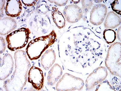 Figure 7:Immunohistochemical analysis of paraffin-embedded renal tissues using PLD2 mouse mAb with DAB staining.