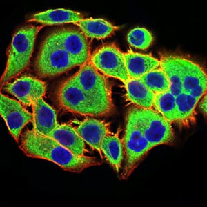 Figure 4:Immunofluorescence analysis of MCF-7 cells using PGRMC1 mouse mAb (green). Blue: DRAQ5 fluorescent DNA dye. Red: Actin filaments have been labeled with Alexa Fluor- 555 phalloidin. Secondary antibody from Fisher (Cat#: 35503)