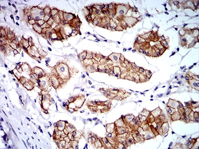 Figure 4:Immunohistochemical analysis of paraffin-embedded stomach tissues using CTNNA1 mouse mAb with DAB staining.