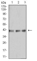 Figure 4:Western blot analysis using B3GAT1 mouse mAb against MOLT4 (1), Raji (2), and Ramos (3) cell lysate.