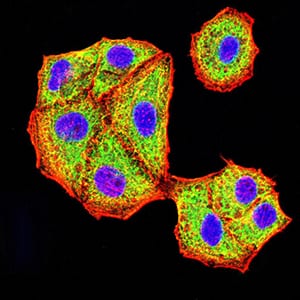 Figure 4:Immunofluorescence analysis of Hela cells using AKT3 mouse mAb (green). Blue: DRAQ5 fluorescent DNA dye. Red: Actin filaments have been labeled with Alexa Fluor- 555 phalloidin. Secondary antibody from Fisher (Cat#: 35503)