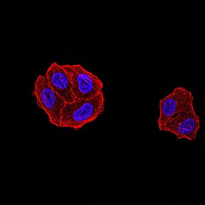 Figure 5:Immunofluorescence analysis of Hela cells using DDX1 mouse mAb. Blue: DRAQ5 fluorescent DNA dye. Red: Actin filaments have been labeled with Alexa Fluor- 555 phalloidin.