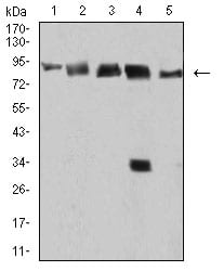 Figure 4:Western blot analysis using DDX1 mouse mAb against Hela (1), MCF-7 (2), A431 (3), PC-3 (4), and Jurkat (5) cell lysate.