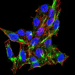 Figure 4:Immunofluorescence analysis of Hela cells using DDX58 mouse mAb (green). Blue: DRAQ5 fluorescent DNA dye. Red: Actin filaments have been labeled with Alexa Fluor- 555 phalloidin. Secondary antibody from Fisher (Cat#: 35503)