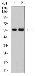 Figure 4:Western blot analysis using DNTT mouse mAb against MOLT4 (1) and Jurkat (2) cell lysate.