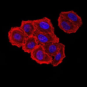 Figure 5:Immunofluorescence analysis of Hela cells using ZFP91 mouse mAb. Blue: DRAQ5 fluorescent DNA dye. Red: Actin filaments have been labeled with Alexa Fluor- 555 phalloidin.