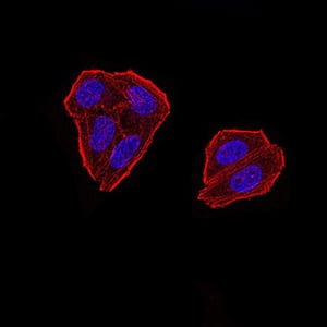 Figure 5:Immunofluorescence analysis of Hela cells using ZFP91 mouse mAb. Blue: DRAQ5 fluorescent DNA dye. Red: Actin filaments have been labeled with Alexa Fluor- 555 phalloidin.