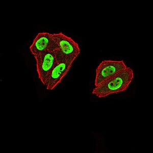 Figure 6:Immunofluorescence analysis of Hela cells using ZFP91 mouse mAb (green). Blue: DRAQ5 fluorescent DNA dye. Red: Actin filaments have been labeled with Alexa Fluor- 555 phalloidin. Secondary antibody from Fisher (Cat#: 35503)