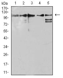 Figure 4:Western blot analysis using ZFP91 mouse mAb against Jurkat (1), A431 (2), HepG2 (3), HEK293 (4), and A549 (5) cell lysate.