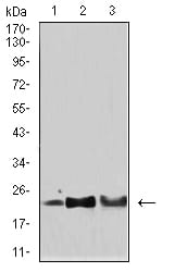 Figure 4:Western blot analysis using SOD2 mouse mAb against Hela (1), HepG2 (2), and SH-SY5Y (3) cell lysate.