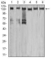 Figure 4:Western blot analysis using MET mouse mAb against A549 (1), COS7 (2), Hela (3), HEK293 (4), HepG2 (5), and A431 (6) cell lysate.