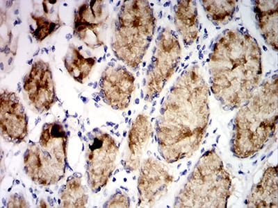 Figure 6:Immunohistochemical analysis of paraffin-embedded stomach tissues using MUC5AC mouse mAb with DAB staining.