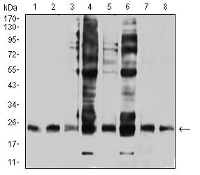 Figure 4:Western blot analysis using RALB mouse mAb against HepG2 (1), COS7 (2), NIH/3T3 (3), A549 (4), U251 (5), HT-29 (6), HEK293 (7), and LOVO (8) cell lysate.