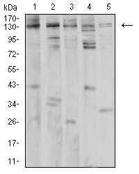 Figure 4:Western blot analysis using PLCG1 mouse mAb against Jurkat (1), K562 (2), A431 (3), Hela (4), and PC-12 (5) cell lysate.