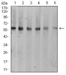 Figure 4:Western blot analysis using KRT10 mouse mAb against A431 (1), C6 (2), COS7 (3), Jurkat (4), NIH/3T3 (5), and HEK293 (6) cell lysate.