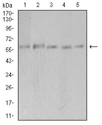 Figure 4:Western blot analysis using PAK3 mouse mAb against Hela (1), SK-N-SH (2), T47D (3), COS7 (4), and HepG2 (5) cell lysate.