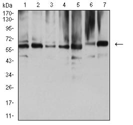 Figure 4:Western blot analysis using NAA10 mouse mAb against COS7 (1), HEK293 (2), HL-60 (3), MCF-7 (4), Hela (5), NIH/3T3 (6), and C2C12 (7) cell lysate.