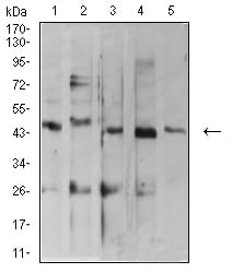 Figure 4:Western blot analysis using ARFGAP1 mouse mAb against MOLT4 (1), C2C12 (2), HepG2 (3), MCF-7 (4), and Lncap (5) cell lysate.