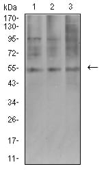 Figure 4:Western blot analysis using AEBP2 mouse mAb against COS7 (1), HepG2 (2), and SK-MES-1 (3) cell lysate.