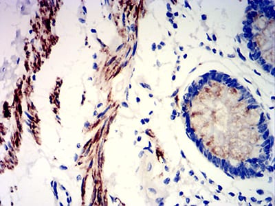 Figure 5:Immunohistochemical analysis of paraffin-embedded rectum tissues using PRKAG3 mouse mAb with DAB staining.