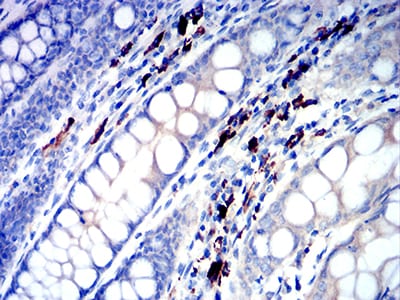 Figure 4:Immunohistochemical analysis of paraffin-embedded colon tissues using IGLC2 mouse mAb with DAB staining.