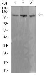 Figure 4:Western blot analysis using ADAR mouse mAb against Ramos (1), K562 (2), and Jurkat (3) cell lysate.