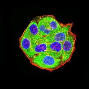 Figure 4:Immunofluorescence analysis of Hela cells using ADAR mouse mAb (green). Blue: DRAQ5 fluorescent DNA dye. Red: Actin filaments have been labeled with Alexa Fluor- 555 phalloidin. Secondary antibody from Fisher (Cat#: 35503)